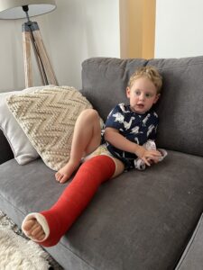2 year old breaks leg